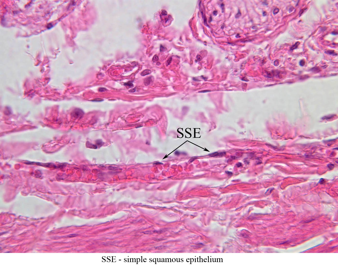 a28 simple squamous epithelium renal artery vein 40x he labeled.jpg